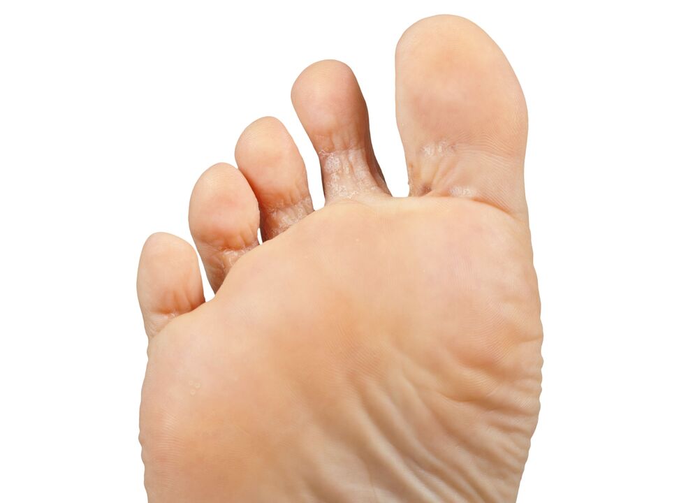 Funger Good-and Pair-and Hectic-Cream-Demyxil