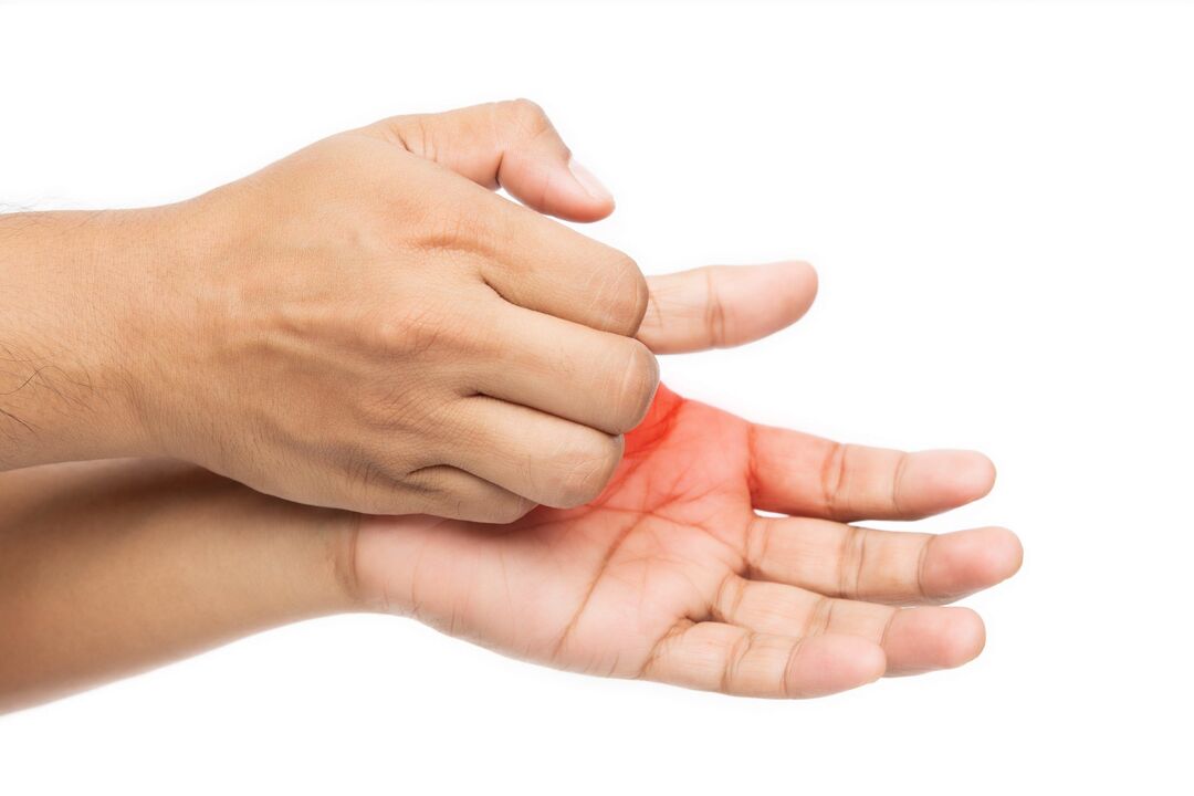 Treatment of itching, fungi and its Demyxil cream