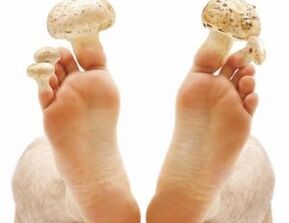 How to Treat Fungus on Toenails